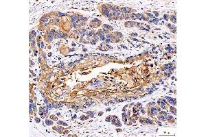 IHC analysis of EML4 using anti-EML4 antibody (ABIN6719384). (EML4 anticorps  (AA 207-423))