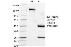 SDS-PAGE Analysis Purified CK17 Mouse Monoclonal Antibody (KRT17/778). (KRT17 anticorps)