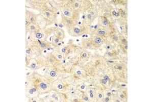 Immunohistochemistry of paraffin-embedded human liver injury using DNM1L antibody (ABIN5971410) at dilution of 1/100 (40x lens).
