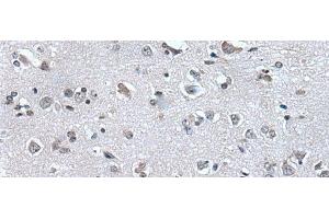 Immunohistochemistry of paraffin-embedded Human brain tissue using HAND1 Polyclonal Antibody at dilution of 1:30(x200)