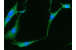 ICC/IF analysis of NSE in U87MG cells line, stained with DAPI (Blue) for nucleus staining and monoclonal anti-human NSE antibody (1:100) with goat anti-mouse IgG-Alexa fluor 488 conjugate (Green).