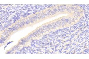 Detection of SCRN1 in Mouse Uterus Tissue using Polyclonal Antibody to Secernin 1 (SCRN1)