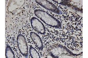 Image no. 1 for anti-RAB GTPase Activating Protein 1-Like (RABGAP1L) (AA 1-111) antibody (ABIN599499) (RABGAP1L anticorps  (AA 1-111))