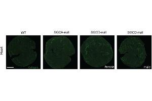 Immunofluorescence images of the heart stained with collagen type I (fibrotic marker, green) using ABIN135046.