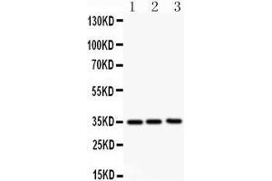 Anti- GM-CSF antibody, Western blotting All lanes: Anti GM-CSF  at 0.