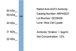 WB Suggested Anti-GGT2  Antibody Titration: 0. (gGT2 anticorps  (N-Term))