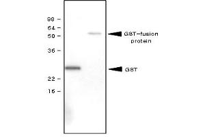 Western Blotting (WB) image for anti-Glutathione S Transferase (GST) antibody (ABIN165402) (GST anticorps)
