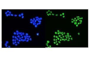 IF analysis of HNRNPD using anti-HNRNPD antibody (ABIN7602590).