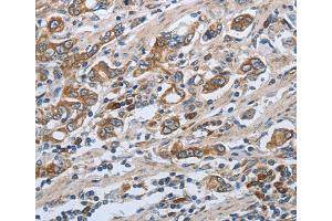Immunohistochemistry (IHC) image for anti-Solute Carrier Family 34 (Sodium Phosphate), Member 2 (SLC34A2) antibody (ABIN2431831) (SLC34A2 anticorps)