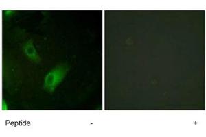 Immunofluorescence analysis of HeLa cells, using ACO1 polyclonal antibody . (Aconitase 1 anticorps)