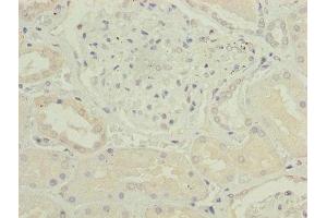 Immunohistochemistry of paraffin-embedded human kidney tissue using ABIN7148927 at dilution of 1:100 (CKS2 anticorps  (Regulatory Subunit 2))