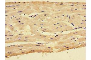 Immunohistochemistry of paraffin-embedded human heart tissue using ABIN7148772 at dilution of 1:100 (CX3CR1 anticorps  (AA 298-351))