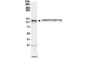 anti-Thyroid Hormone Receptor Associated Protein 3 (THRAP3) (AA 375-425) antibody