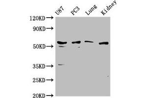 Western Blot Positive WB detected in: U87 whole cell lysate, PC3 whole cell lysate, Mouse lung tissue, Mouse kidney tissue All lanes: PPP5C antibody at 1:1000 Secondary Goat polyclonal to rabbit IgG at 1/50000 dilution Predicted band size: 57 kDa Observed band size: 57 kDa (PP5 anticorps  (AA 370-488))
