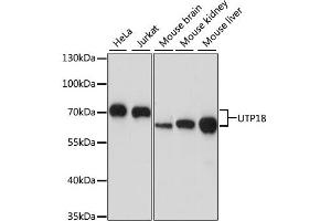 Western blot analysis of extracts of various cell lines, using UTP18 antibody. (UTP18 anticorps)