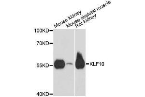 Western blot analysis of extracts of various cell lines, using KLF10 antibody. (KLF10/TIEG1 anticorps  (AA 161-365))