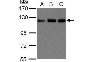 WB Image Sample (30 ug of whole cell lysate) A: 293T B: A431 , C: H1299 15% SDS PAGE antibody diluted at 1:1500 (KIF5B anticorps  (C-Term))