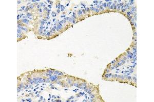 Immunohistochemistry of paraffin-embedded Mouse lung using STRN3 Polyclonal Antibody at dilution of 1:100 (40x lens). (STRN3 anticorps)
