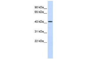 Carboxypeptidase B2 antibody used at 1 ug/ml to detect target protein. (CPB2 anticorps)
