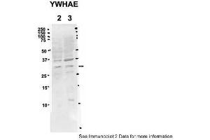 Sample Type: 2. (YWHAE anticorps  (C-Term))