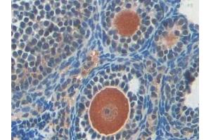 Detection of PARP in Mouse Ovary Tissue using Polyclonal Antibody to Poly ADP Ribose Polymerase (PARP)