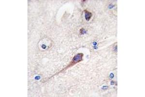 Image no. 3 for anti-Hippocalcin (HPCA) (N-Term) antibody (ABIN357112) (Hippocalcin anticorps  (N-Term))