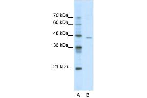 ACCN4 antibody used at 0. (ACCN4 anticorps  (N-Term))