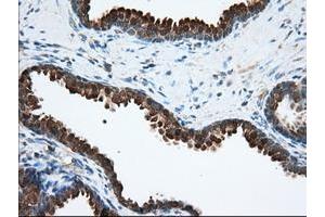 Image no. 2 for anti-Acetyl-CoA Acetyltransferase 2 (ACAT2) antibody (ABIN1496404)