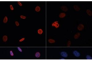 Immunofluorescence analysis of NIH/3T3 cells using Acetyl-Histone H2B-K15 Polyclonal Antibody at dilution of 1:100. (Histone H2B anticorps  (acLys15))