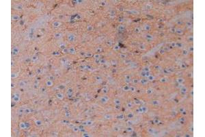 IHC-P analysis of Mouse Brain Tissue, with DAB staining. (Aquaporin 4 anticorps  (AA 177-304))