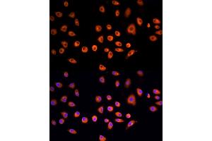 Immunofluorescence analysis of L929 cells using EPS15 Rabbit pAb  at dilution of 1:200 (40x lens).