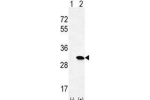 Western Blotting (WB) image for anti-HRas proto-oncogene, GTPase (HRAS) antibody (ABIN2996311) (HRAS anticorps)