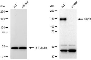 Western blotting analysis using CD13 antibody (ABIN7797548).