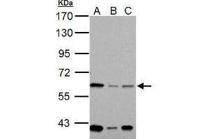 WB Image Sample (30 ug of whole cell lysate) A: 293T B: A431 C: HeLa 7.