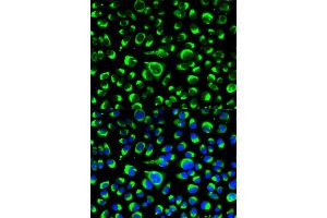 Immunofluorescence analysis of HeLa cells using P4HB antibody. (P4HB anticorps)
