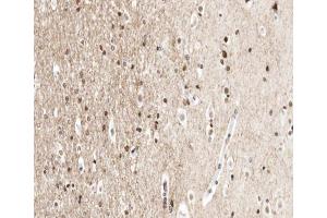 ABIN6266670 at 1/100 staining human brain tissue sections by IHC-P.