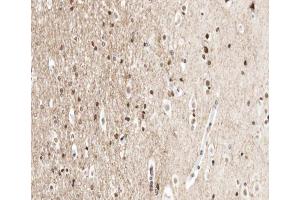 ABIN6266670 at 1/100 staining human brain tissue sections by IHC-P. (UBA52 anticorps  (Internal Region))