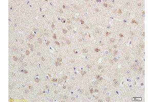 Formalin-fixed and paraffin embedded rat brain labeled with Anti-CDH2/N-cadherin Polyclonal Antibody, Unconjugated  at 1:200 followed by conjugation to the secondary antibody and DAB staining.