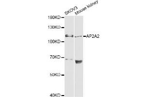 Western blot analysis of extracts of various cell lines, using AP2A2 antibody (ABIN6292468) at 1:1000 dilution. (AP2A2 anticorps)