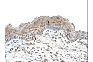 TAPBP antibody was used for immunohistochemistry at a concentration of 4-8 ug/ml. (TAPBP anticorps)