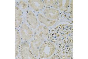 Immunohistochemistry of paraffin-embedded human kidney using CAMK1D Antibody (ABIN5975586) at dilution of 1/100 (40x lens). (CAMK1D anticorps)