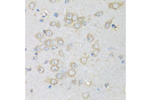 Immunohistochemistry of paraffin-embedded rat brain using CHMP1B antibody (ABIN5974811) at dilution of 1/100 (40x lens). (CHMP1B anticorps)
