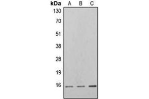 Western blot analysis of 4EBP1 (pT46) expression in K562 PMA-treated (A), NIH3T3 PMA-treated (B), PC12 PMA-treated (C) whole cell lysates.