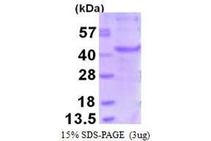 Image no. 1 for Melanoma Antigen Family A, 6 (MAGEA6) (AA 1-314) protein (His tag) (ABIN6386967)