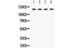 Anti- SLC12A1 Picoband antibody, Western blotting All lanes: Anti SLC12A1  at 0. (SLC12A1 anticorps  (N-Term))