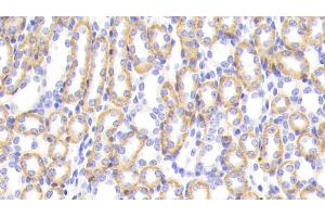 Detection of CTSS in Mouse Kidney Tissue using Polyclonal Antibody to Cathepsin S (CTSS) (Cathepsin S anticorps  (AA 123-339))