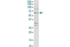 TJAP1 monoclonal antibody (M01), clone 2E5.