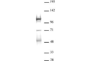 DNMT3B antibody (pAb) tested by Western blot. (DNMT3B anticorps  (AA 1-218))