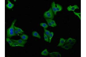 Immunofluorescence staining of HepG2 cells with ABIN7149404 at 1:100, counter-stained with DAPI. (PLA2G4B anticorps  (AA 514-781))