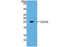 Western blot analysis of recombinant Rat EPO. (EPO anticorps  (AA 28-192))
